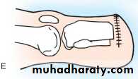 orthopedic operations