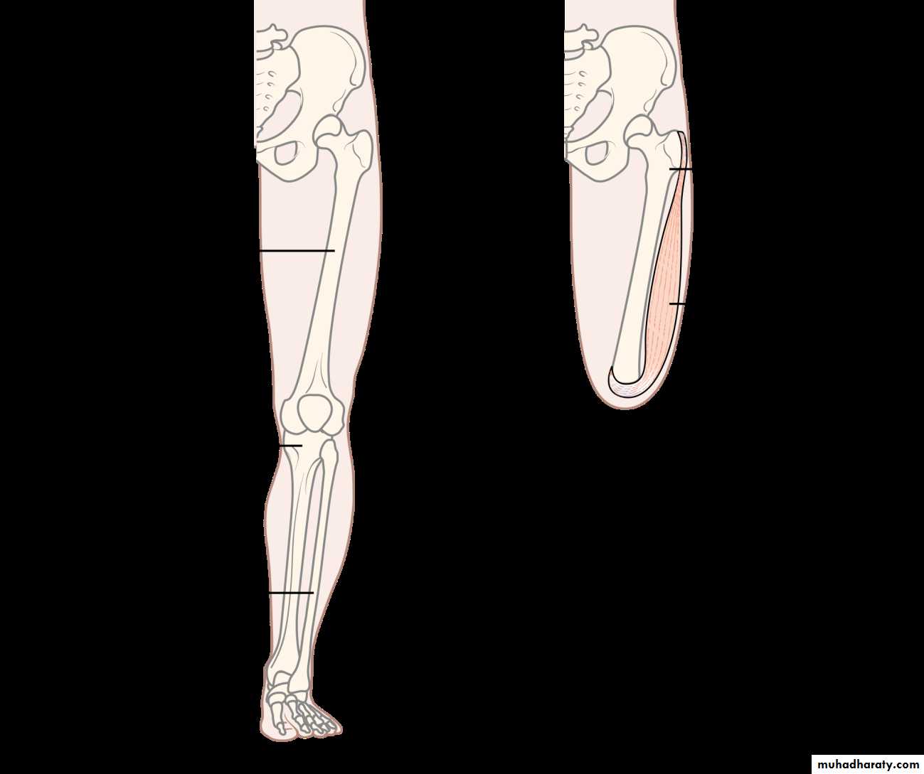 orthopedic operations