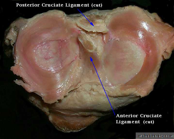 knee disease