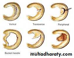knee disease