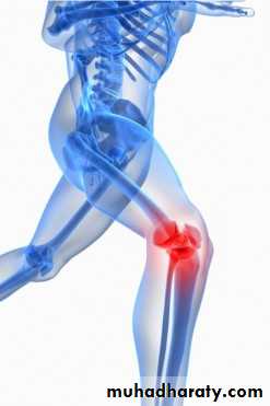 knee disease