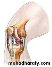 knee disease