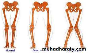 knee disease