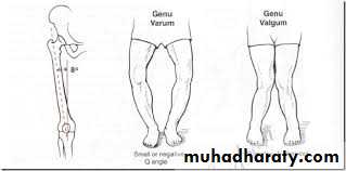 knee disease