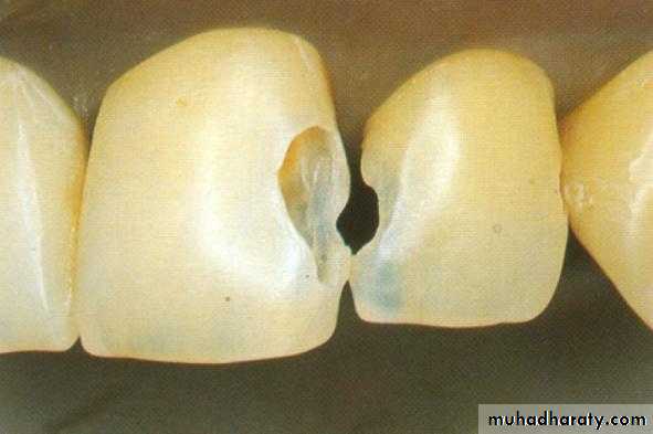Principle of adhesion