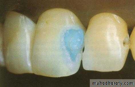 Principle of adhesion