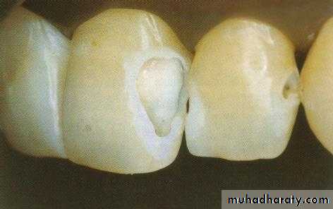 Principle of adhesion