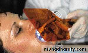 Principle of adhesion