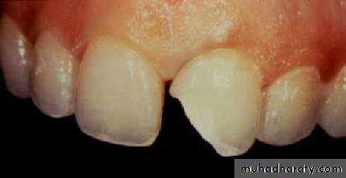 Principle of adhesion