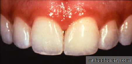 Principle of adhesion