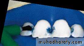 Principle of adhesion