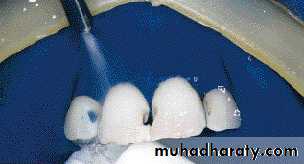 Principle of adhesion