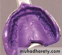 elastomeric impression