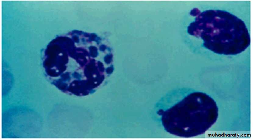 Ulcerated vesicular