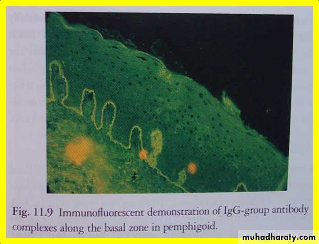 Ulcerated vesicular