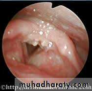 larynx