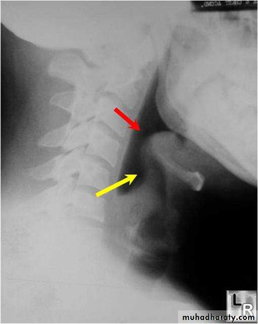 larynx