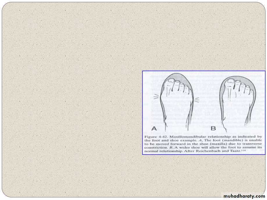 Expansion in orthodontics