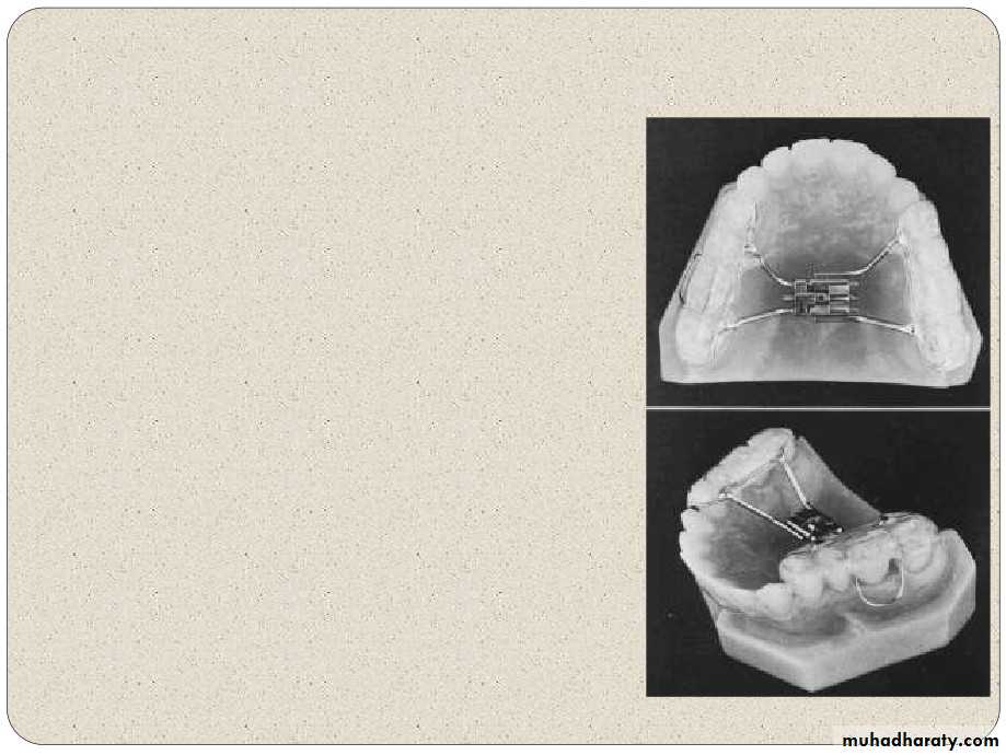 Expansion in orthodontics