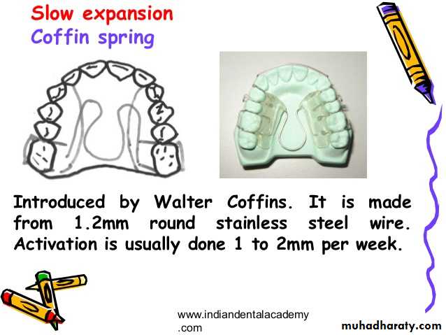 Expansion in orthodontics