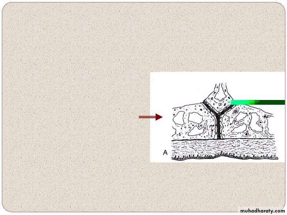 Expansion in orthodontics