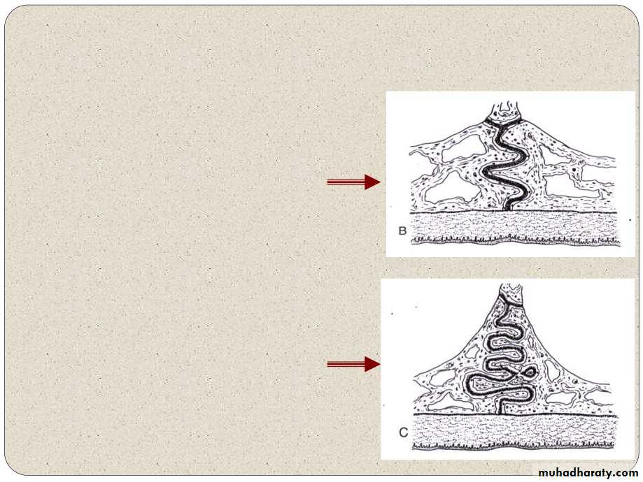 Expansion in orthodontics
