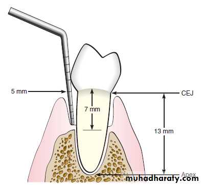 Phase l periodontal therapy