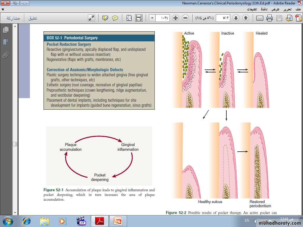 Phase ll periodontal therapy