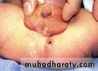 SURGERY OF THE ANAL CANAL