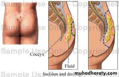 SURGERY OF THE ANAL CANAL