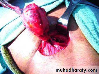Embryology