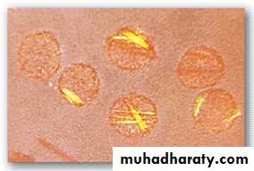 Nucleic acids