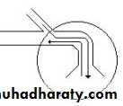 Breathing Circuits In Anaesthesia