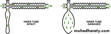 Breathing Circuits In Anaesthesia