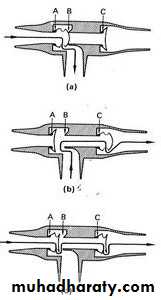 Breathing Circuits In Anaesthesia