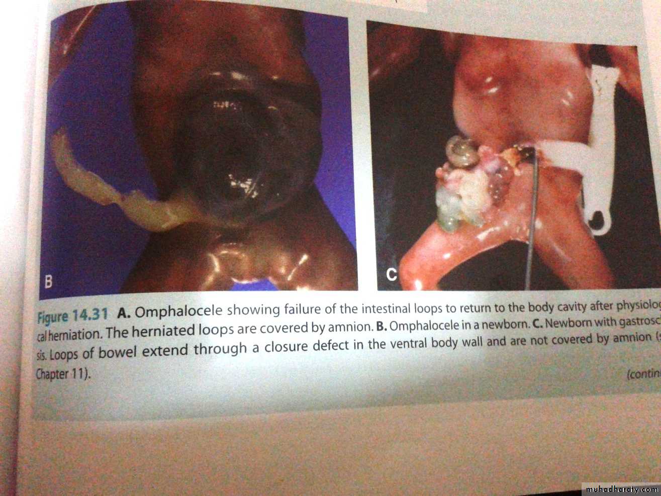Embryology