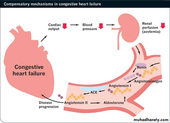 heart failure