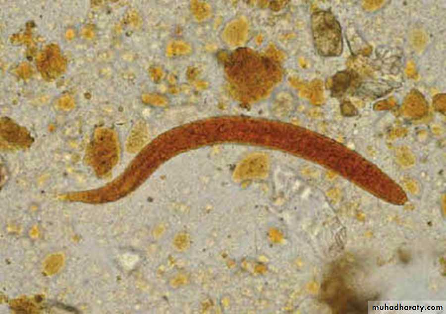 Strongyloides stercoralis