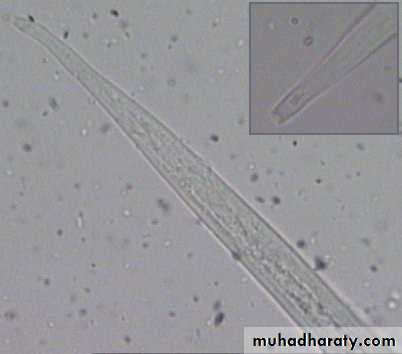 Strongyloides stercoralis