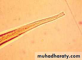 Strongyloides stercoralis