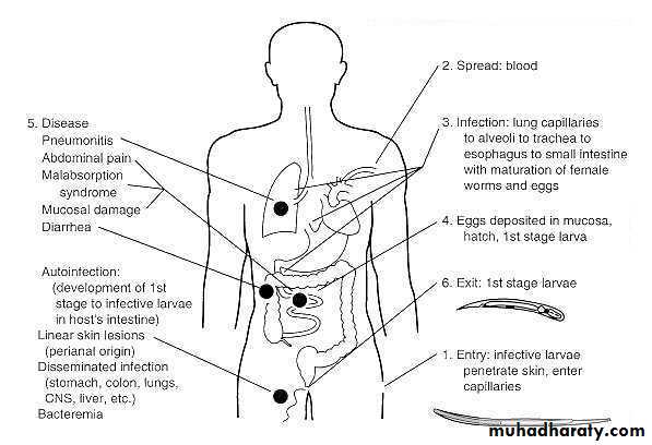 Strongyloides stercoralis