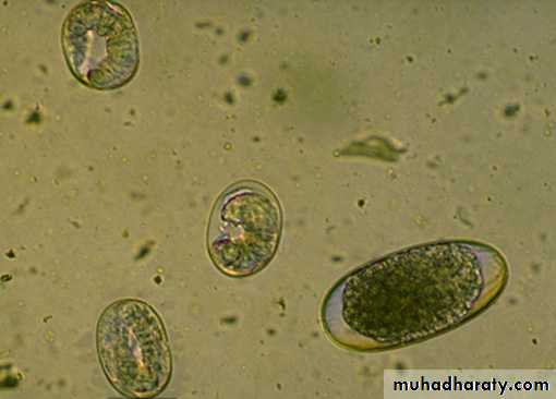 Strongyloides stercoralis
