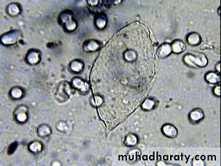Schistosoma spp.