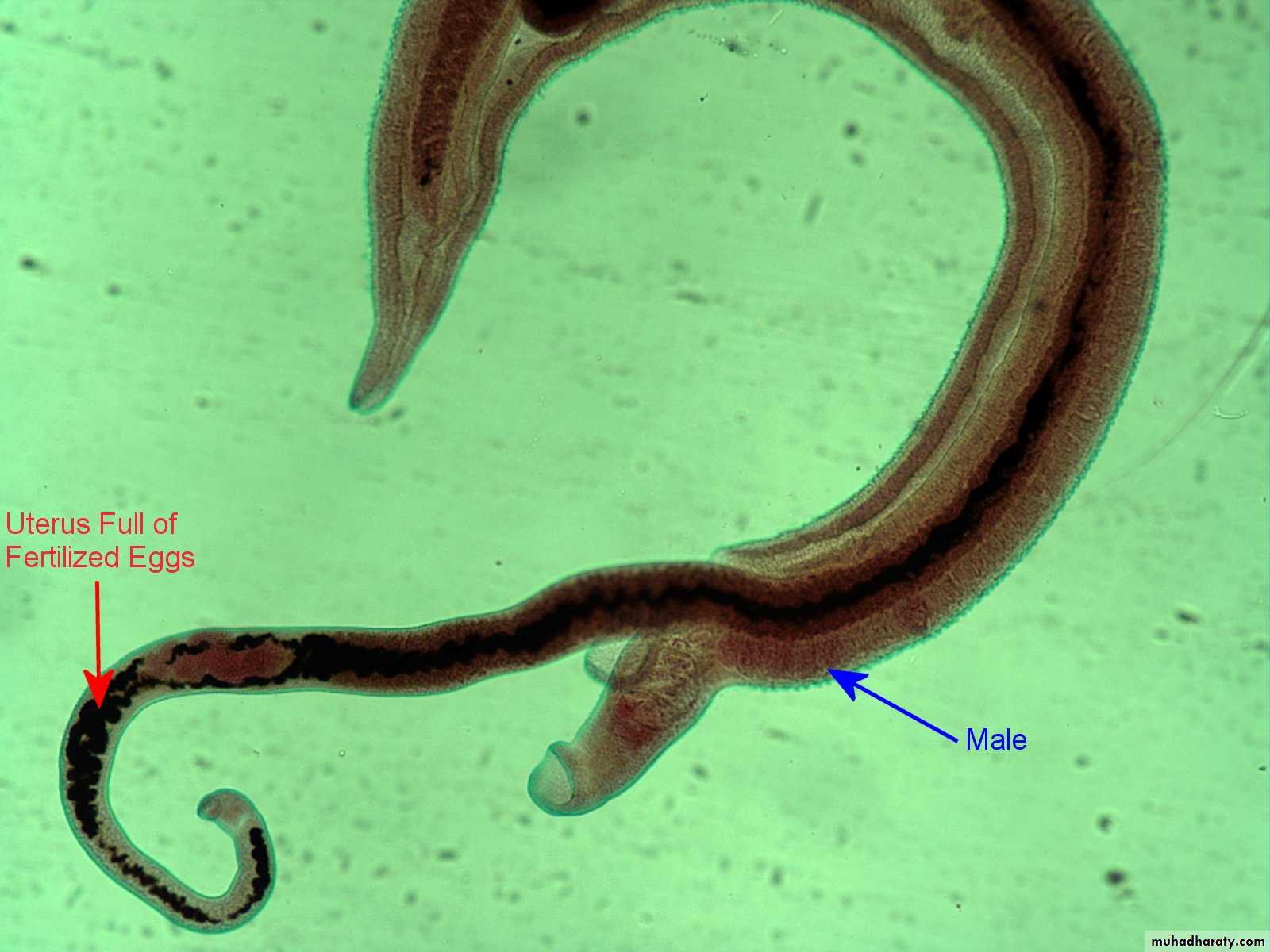 Schistosoma spp.