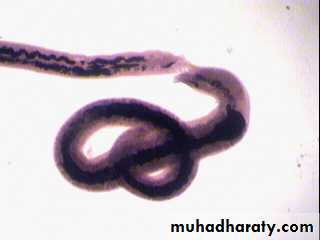 Schistosoma spp.