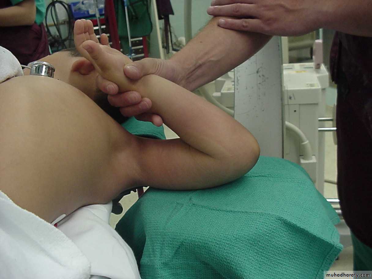 supracondyler تأشيرات