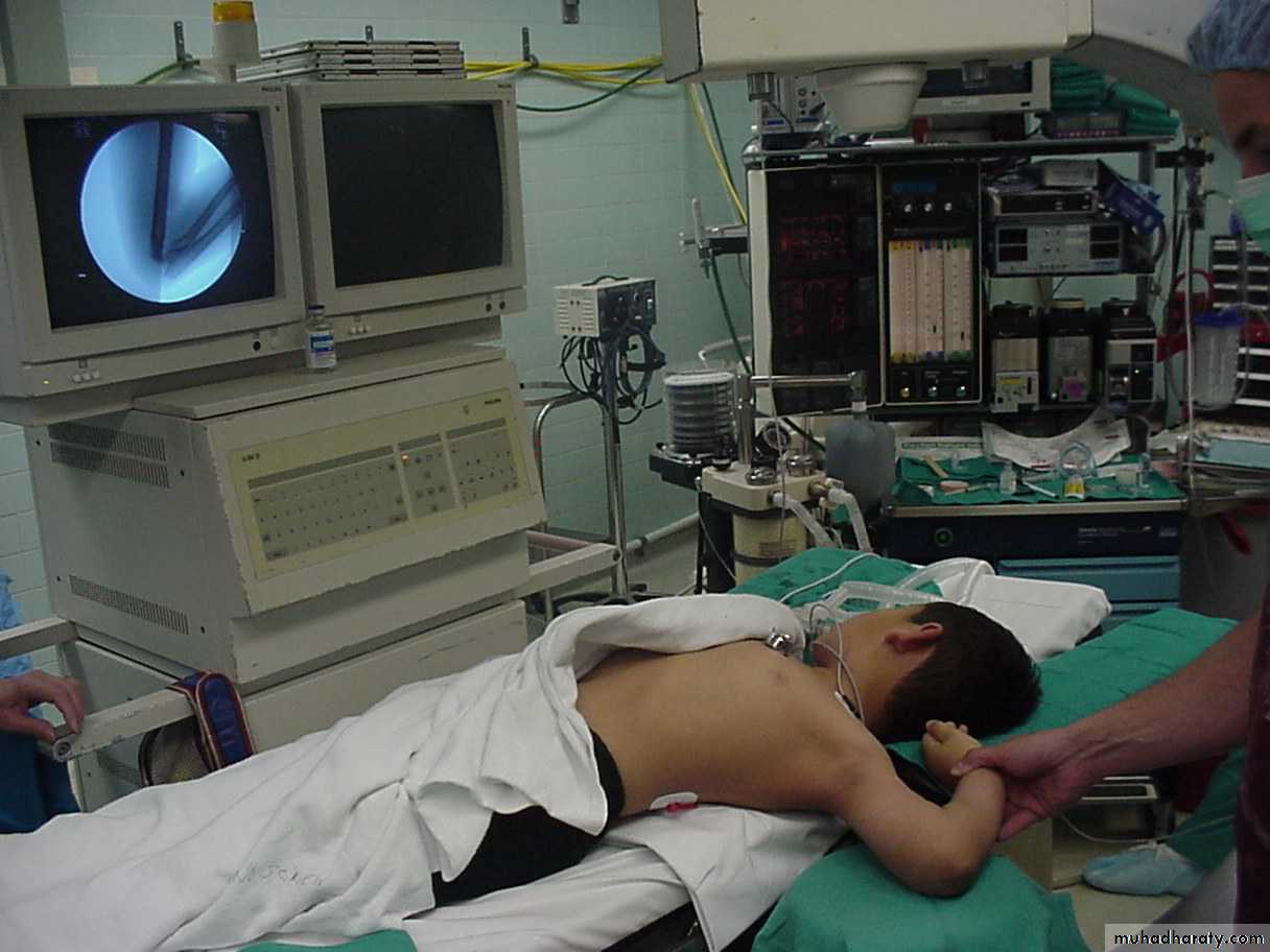 supracondyler تأشيرات