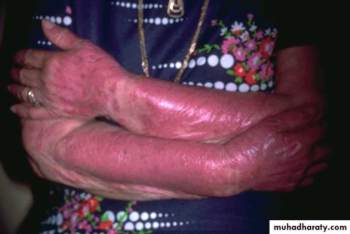 Antibiotics that inhibit protein synthesis