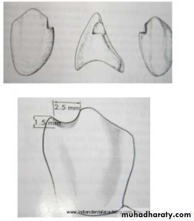 mouth preparation for removable partial denture