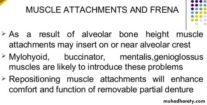 mouth preparation for removable partial denture